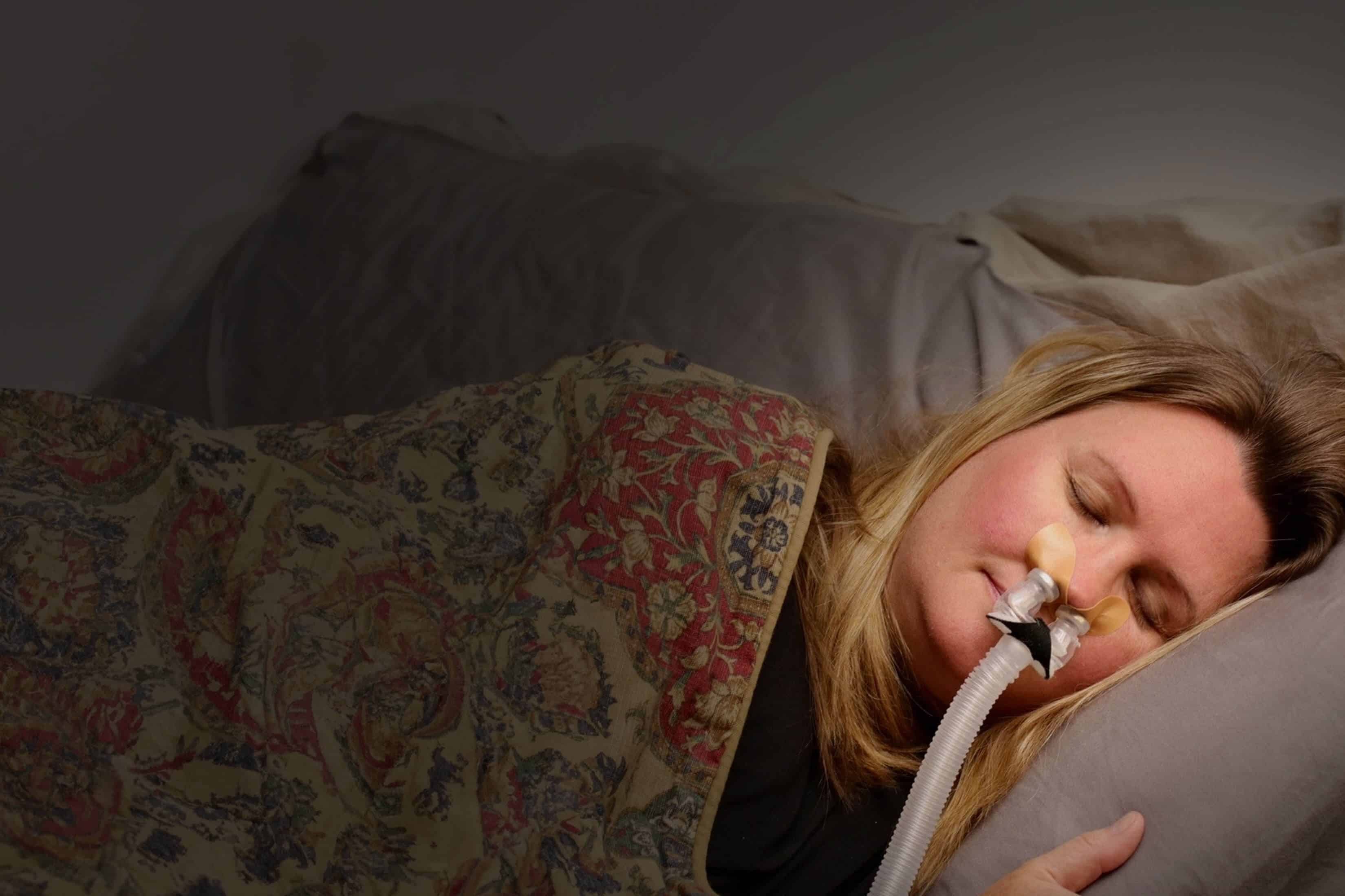 The Hidden Link Between CPAP Therapy and Skin Conditions